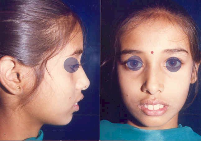 Copy of malur1.jpg (33187 bytes)