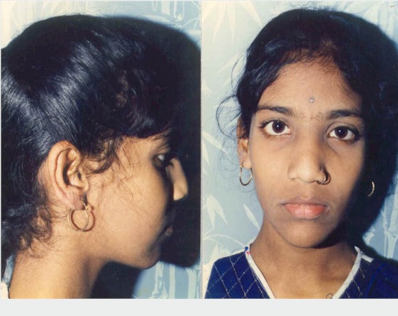 wpe18.jpg (56052 bytes)