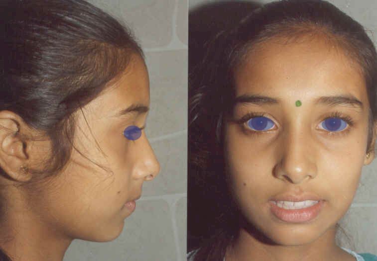 malur4.jpg (31971 bytes)