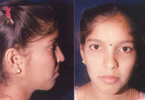 wpe14.jpg (12860 bytes)