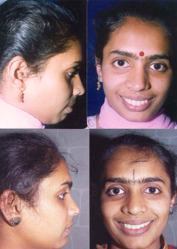 wpe1B.jpg (58791 bytes)